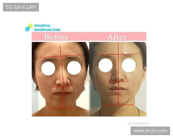 “整容日记”：面部变迁中的自我探索与蜕变之路